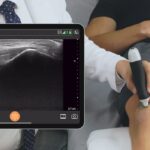 Clarius Mobile Health