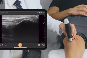 Clarius Mobile Health