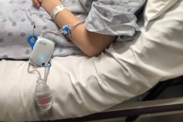 An Origin device attached to the arm of a person wearing a hospital gown and bracelet.
